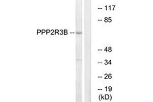 Western blot analysis of extracts from K562 cells, using PPP2R3B Antibody. (PPP2R3B Antikörper  (AA 364-413))
