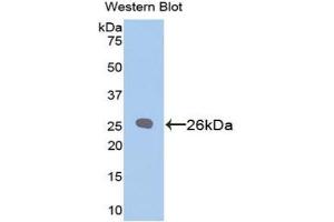 Detection of Recombinant Bcl2, Rat using Polyclonal Antibody to B-Cell Leukemia/Lymphoma 2 (Bcl2) (Bcl-2 Antikörper  (AA 2-208))