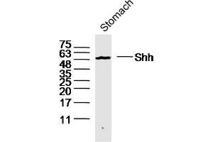 Western Blotting (WB) image for anti-Sonic Hedgehog (SHH) (AA 21-120) antibody (ABIN731108)