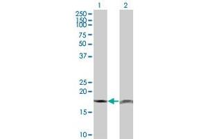 Western Blot analysis of PTH expression in transfected 293T cell line by PTH monoclonal antibody (M18), clone 3C2. (PTH Antikörper  (AA 32-115))