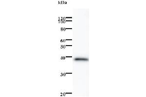 Western Blotting (WB) image for anti-Zinc finger protein ubi-d4 (DPF2) antibody (ABIN932486) (DPF2 Antikörper)