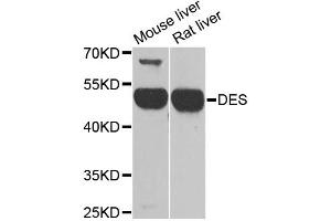 Western blot analysis of extracts of various cell lines, using DES antibody (ABIN1872252) at 1:1000 dilution. (Desmin Antikörper)