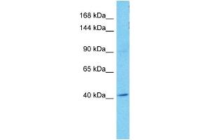 Host:  Rabbit  Target Name:  OSMR  Sample Tissue:  Human A549 Whole Cell  Antibody Dilution:  1ug/ml (Oncostatin M Receptor Antikörper  (N-Term))