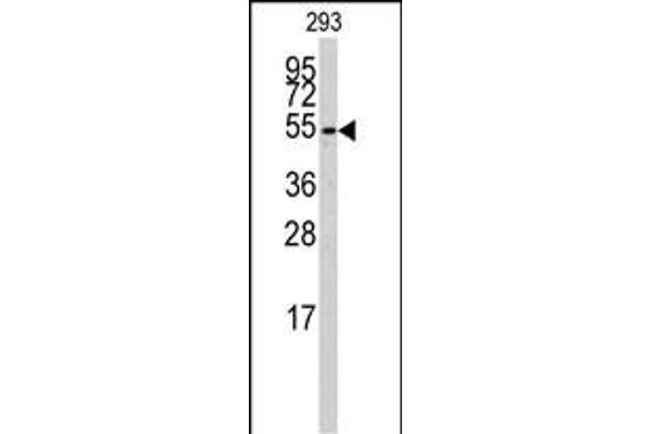 CYP26B1 Antikörper  (C-Term)