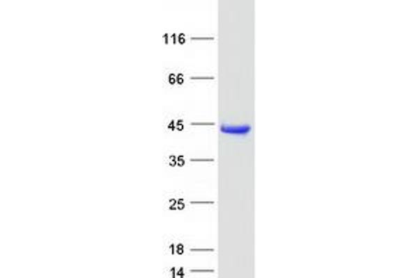 AKR1A1 Protein (Transcript Variant 2) (Myc-DYKDDDDK Tag)