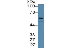 Western Blotting (WB) image for Lipopolysaccharide Binding Protein (LBP) ELISA Kit (ABIN6720569)