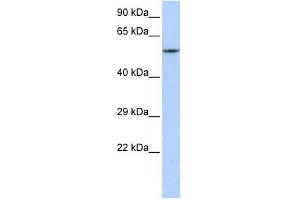 CACNB1 antibody used at 1 ug/ml to detect target protein. (CACNB1 Antikörper  (C-Term))