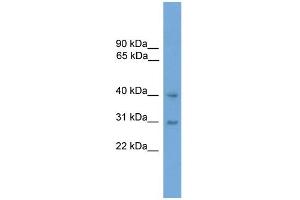 WB Suggested Anti-MAPK13 Antibody Titration: 0. (MAPK13 Antikörper  (Middle Region))
