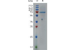 HPSE Protein (AA 36-543) (His tag)