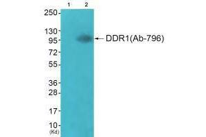 Western blot analysis of extracts from JK cells (Lane 2), using DDR1 (Ab-796) antiobdy. (DDR1 Antikörper  (Tyr796))