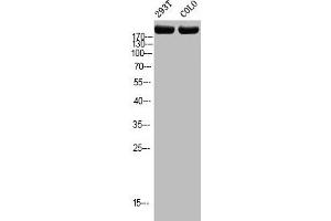 Western blot analysis of 293T COLO using p-Topo IIα (T1343) antibody. (Topoisomerase II alpha Antikörper  (pSer1343))