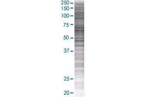 TBCD transfected lysate. (TBCD 293T Cell Transient Overexpression Lysate(Denatured))