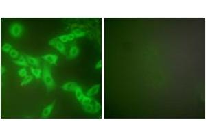 Immunofluorescence (IF) image for anti-Cystatin B (Stefin B) (CSTB) (AA 49-98) antibody (ABIN2889258) (CSTB Antikörper  (AA 49-98))