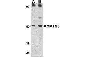 Western Blotting (WB) image for anti-Matrilin 3 (MATN3) (C-Term) antibody (ABIN1030509) (Matrilin 3 Antikörper  (C-Term))