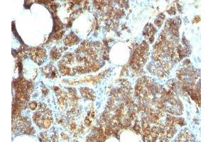 Image no. 2 for anti-Parathyroid Hormone (PTH) (C-Term) antibody (ABIN6166676) (PTH Antikörper  (C-Term))