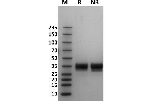 Human Fc gamma RIIb / CD32b protein on Coomassie Blue stained SDS-PAGE under non-reducing (NR) and reducing (R) conditions. (FCGR2B Protein (AA 46-217) (His-Avi Tag,Biotin))