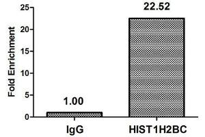Chromatin Immunoprecipitation Hela (10 6 , treated with 30 mM sodium butyrate for 4h) were treated with Micrococcal Nuclease, sonicated, and immunoprecipitated with 5 μg anti-HIST1H2BC (ABIN7139155) or a control normal rabbit IgG. (Histone H2B Antikörper  (acLys120))