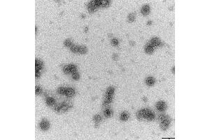 Transmission electron microscopy (TEM) image for Human Papilloma Virus 6 Capsid Protein (HPV-6 L1) protein-VLP (ABIN7540347)