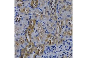 Immunohistochemistry of paraffin-embedded rat kidney using TNFRSF6B antibody (ABIN5970241) at dilution of 1/200 (40x lens). (TNFRSF6B Antikörper)