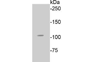 Lane 1: A549 lysates probed with Rb(S807) (2D10) Monoclonal Antibody  at 1:1000 overnight at 4˚C. (Retinoblastoma 1 Antikörper  (pSer807))