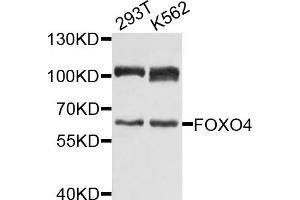 Western blot analysis of extracts of various cell lines, using FOXO4 antibody (ABIN1872735) at 1:1000 dilution. (FOXO4 Antikörper)