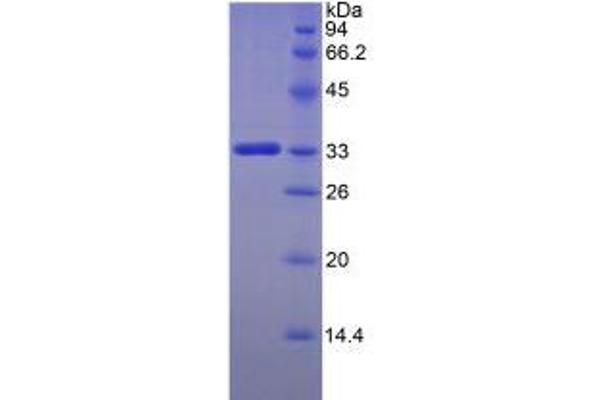 FKBP10 Protein