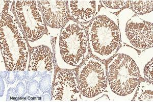 Immunohistochemical analysis of paraffin-embedded rat testis tissue. (NF-kB p65 Antikörper  (acLys310))