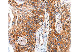 Immunohistochemistry (IHC) image for anti-G Protein-Coupled Receptor Kinase 1 (GRK1) antibody (ABIN1872898) (GRK1 Antikörper)