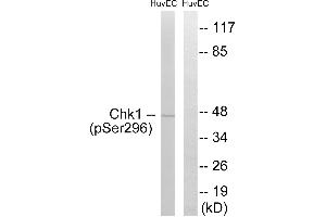 Western blot analysis of extracts from HUVEC cells, treated with UV (15 mins), using Chk1 (Phospho-Ser296) antibody. (CHEK1 Antikörper  (pSer296))