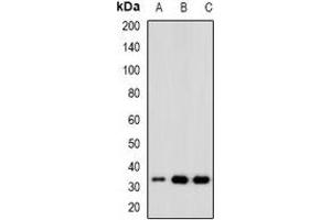 Western blot analysis of CDK6 expression in Hela (A), Jurkat (B), K562 (C) whole cell lysates. (CDK6 Antikörper)