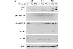 Western Blotting (WB) image for anti-Sequestosome 1 (SQSTM1) antibody (ABIN2854836)