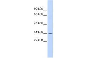Image no. 1 for anti-Nuclear Factor of kappa Light Polypeptide Gene Enhancer in B-Cells Inhibitor, alpha (NFKBIA) (N-Term) antibody (ABIN6744336) (NFKBIA Antikörper  (N-Term))