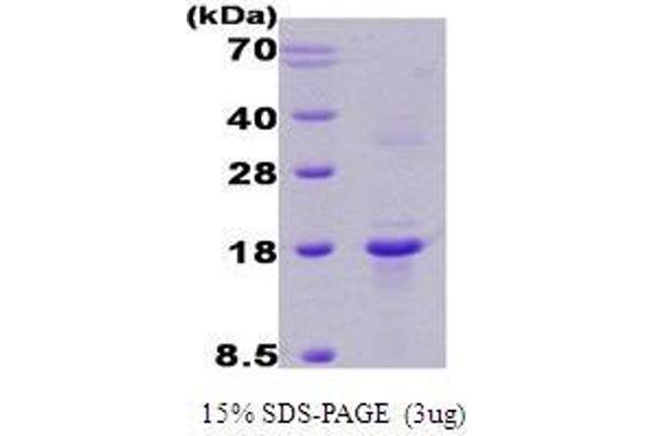 RCAN1 Protein (AA 1-117, Isoform B)