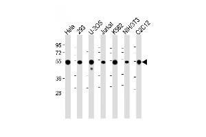 Western Blotting (WB) image for anti-Vimentin (VIM) antibody (ABIN1881993)