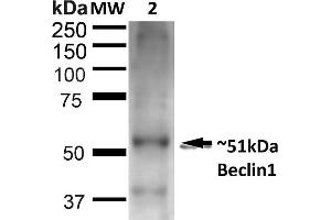 Western blot analysis of Rat Liver showing detection of ~51 kDa Beclin 1 protein using Rabbit Anti-Beclin 1 Polyclonal Antibody (ABIN2868749). (Beclin 1 Antikörper  (APC))