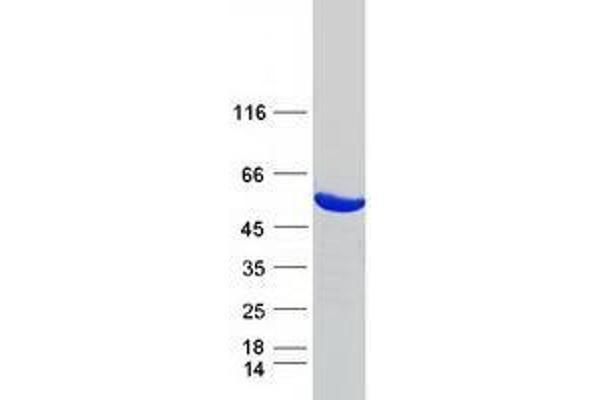 UMPS Protein (Myc-DYKDDDDK Tag)