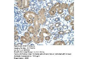 Rabbit Anti-TRNT1 Antibody  Paraffin Embedded Tissue: Human Kidney Cellular Data: Epithelial cells of renal tubule Antibody Concentration: 4. (Trnt1 Antikörper  (N-Term))