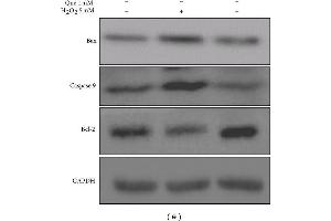 Western Blotting (WB) image for anti-B-Cell CLL/lymphoma 2 (BCL2) (N-Term) antibody (ABIN2857047)