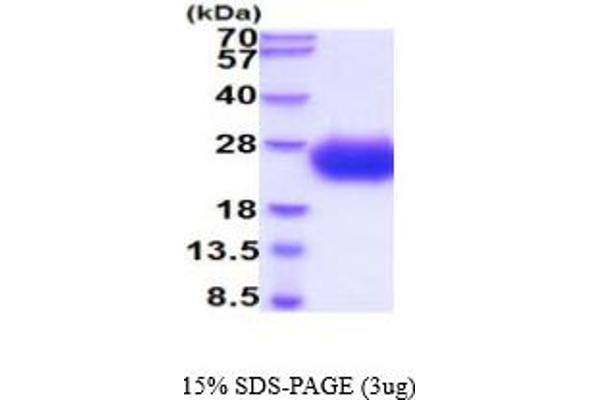 SCN3B Protein (AA 23-159) (His tag)