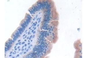 Detection of TNFa in Mouse Uterus Tissue using Monoclonal Antibody to Tumor Necrosis Factor Alpha (TNFa) (TNF alpha Antikörper  (AA 80-235))