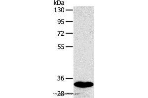Western blot analysis of Human fetal intestines tissue, using SULT1B1 Polyclonal Antibody at dilution of 1:800 (SULT1B1 Antikörper)