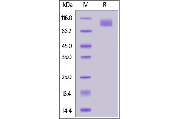 SARS-CoV-2 Spike S2 Protein (P.1 - gamma) (His tag)