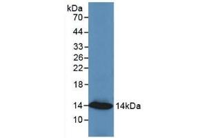 Detection of Recombinant RETN, Human using Monoclonal Antibody to Resistin (RETN) (Resistin Antikörper  (AA 17-108))