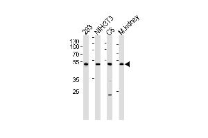 Western blot analysis of lysates from 293, mouse NIH/3T3, rat C6 cell line and mouse kidney tissue lysate(from left to right), using Mouse Cdk9 Antibody at 1:1000 at each lane. (CDK9 Antikörper  (C-Term))