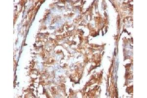 Immunohistochemistry (Formalin-fixed Paraffin-embedded Sections) (IHC (fp)) image for anti-beta-2-Microglobulin (B2M) antibody (ABIN3025743)