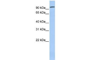 WB Suggested Anti-ZNF777 Antibody Titration:  0. (ZNF777 Antikörper  (Middle Region))