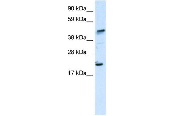 IKZF5 Antikörper  (N-Term)