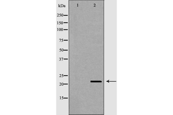 RNASE11 Antikörper  (Internal Region)