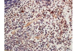 Formalin-fixed and paraffin embedded mouse spleen labeled with Rabbit Anti-FAK (Tyr925) Polyclonal Antibody, Unconjugated  at 1:200 followed by conjugation to the secondary antibody and DAB staining (FAK Antikörper  (pTyr925))