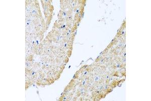 Immunohistochemistry of paraffin-embedded mouse heart using COX6B1 antibody. (COX6B1 Antikörper  (AA 1-86))